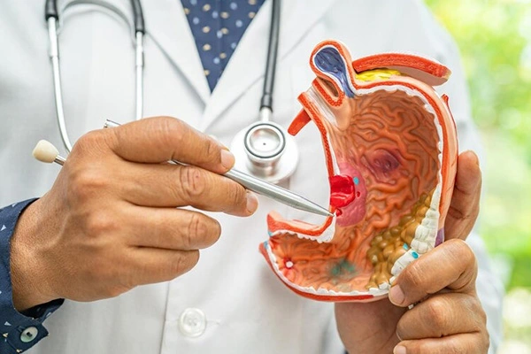 Bariatric Surgery