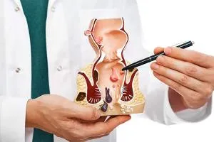 Fissure/Fistula/ Hemorrhoidectomy