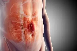 Hernia Surgery (Lap/ Open)