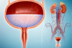 Urology (RIRS | PCNL | URS)