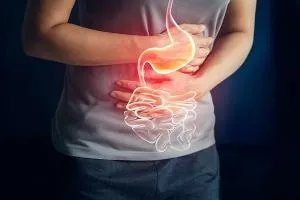 Lap fundoplication