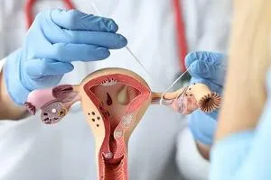 Lap gynecological surgeries