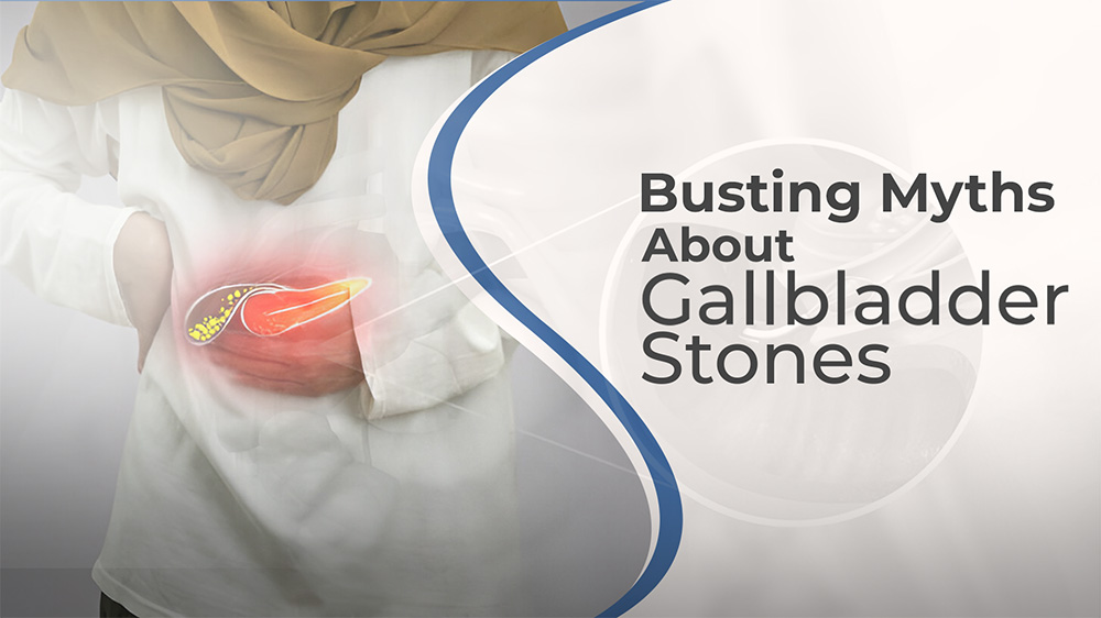 Busting Myths About Gallbladder Stones