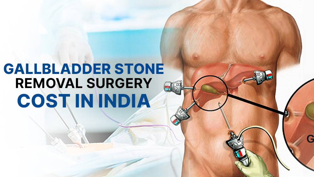 Gallbladder Surgery Cost in India