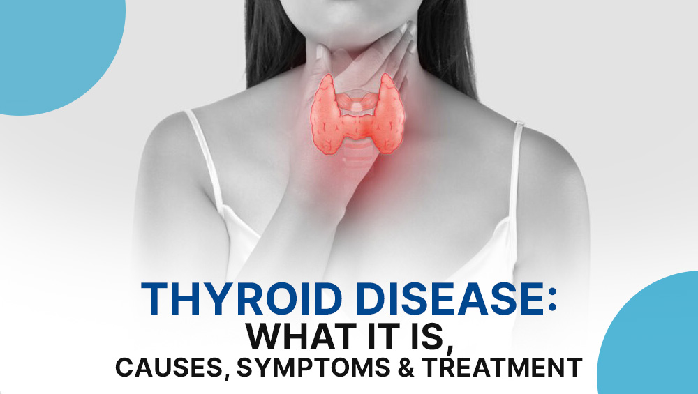 Thyroid Disease