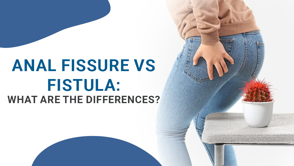 Anal Fissures and Fistulas